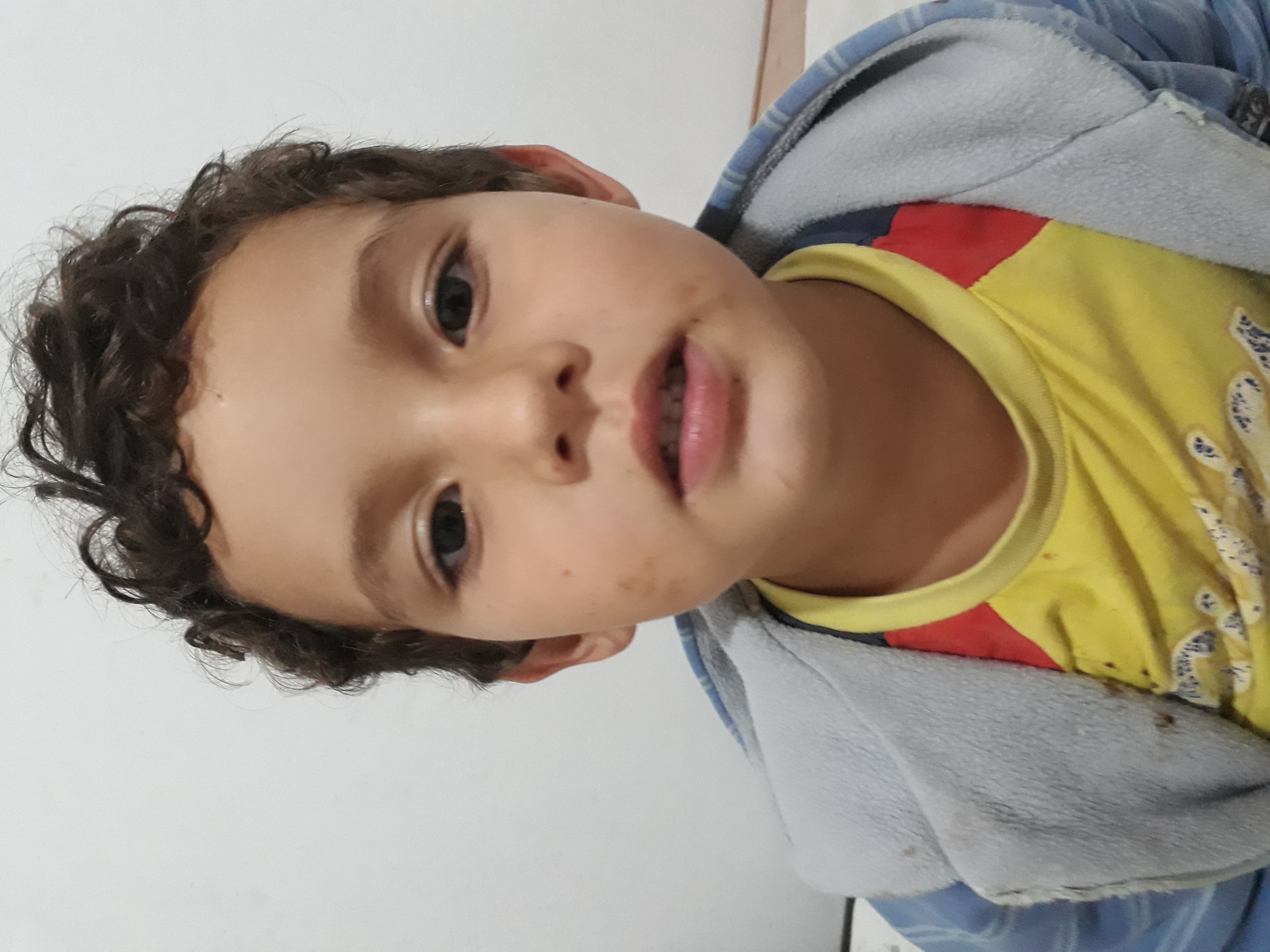 Bola pra Cima